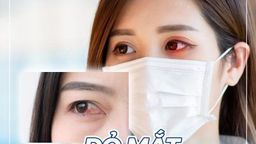 Cảnh giác nguy cơ mắc bệnh vi mạch võng mạc, đỏ mắt hậu Covid-19